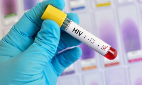 Americké úrady identifikovali prvý zdokumentovaný prípad HIV prenesený kozmetickými ihlami