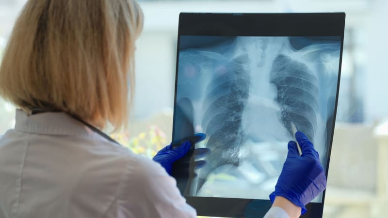Smrtelné onemocnění, které často neodhalí ani lékaři. Jaké jsou příznaky plicní hypertenze?