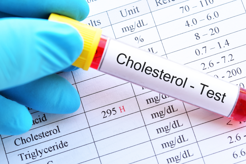 Povinne zaraďte do svojho jedálnička. Cholesterol Vám začne klesať