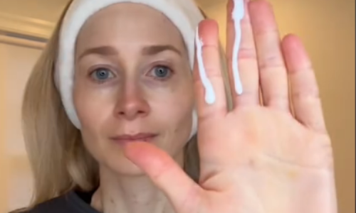 Dermatologička odporúča metódu „dvoch prstov“. Zabudnete na spálenie od slnka