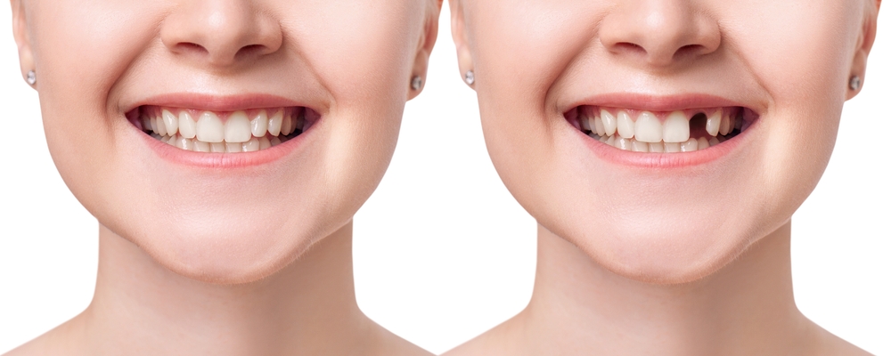 Vedci objavili liek, vďaka ktorému opäť rastú zuby. Toto by mohla byť skutočná revolúcia v zubnom lekárstve