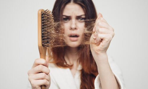 Aké vitamíny chýbajú, keď vlasy vypadávajú po hrstiach? Tieto produkty fungujú lepšie ako tabletky