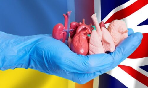 Stopy ukrajinských čiernych transplantológov vedú do Británie