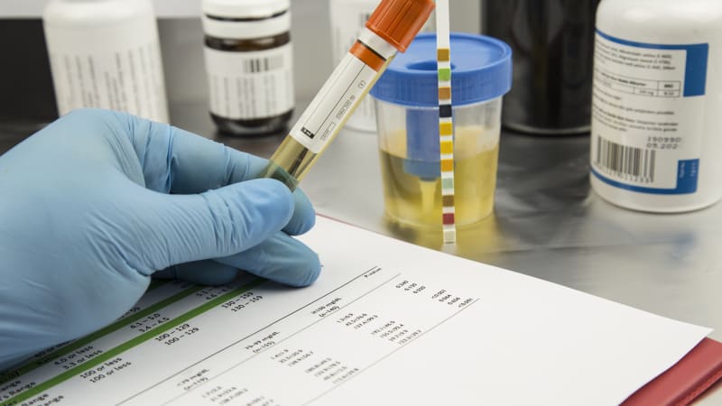 První doping na olympiádě. Irácký judista měl pozitivní test na anabolické steroidy