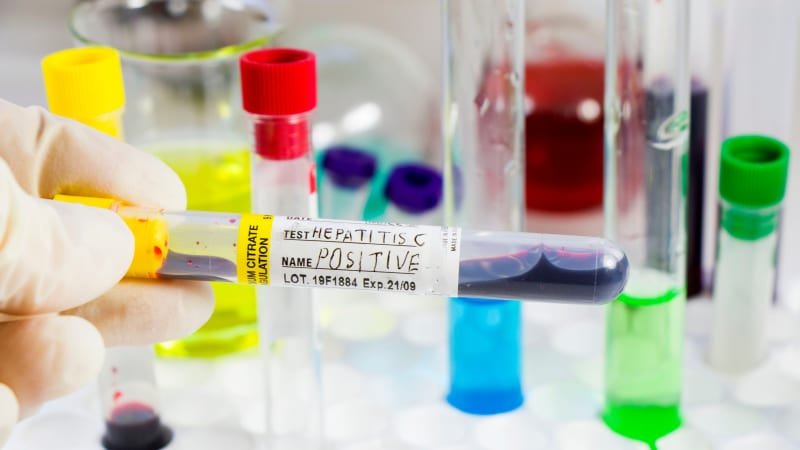 Za „tichým zabijákem“ může stát tetování i jediný experiment s drogou. Léčbu komplikují mýty Za „tichým zabijákem“ může stát tetování i jediný experiment s drogou. Léčbu komplikují mýty