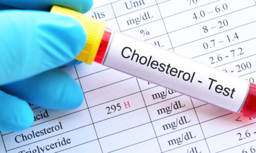 Povinne zaraďte do svojho jedálnička. Cholesterol Vám začne klesať