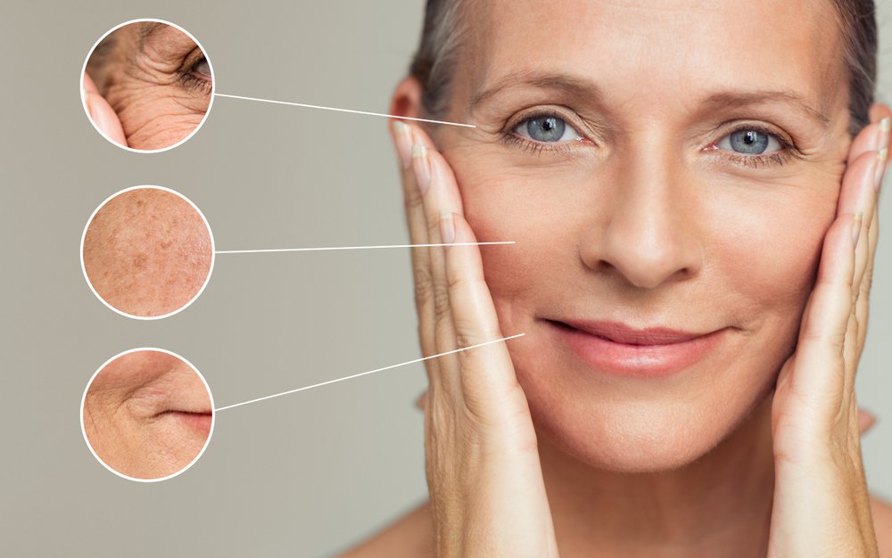 Funguje to ako botox za 100 eur. Namiesto pitia si to naneste na tvár. Rozbije vrásky ako valček Funguje to ako botox za 100 eur. Namiesto pitia si to naneste na tvár. Rozbije vrásky ako valček