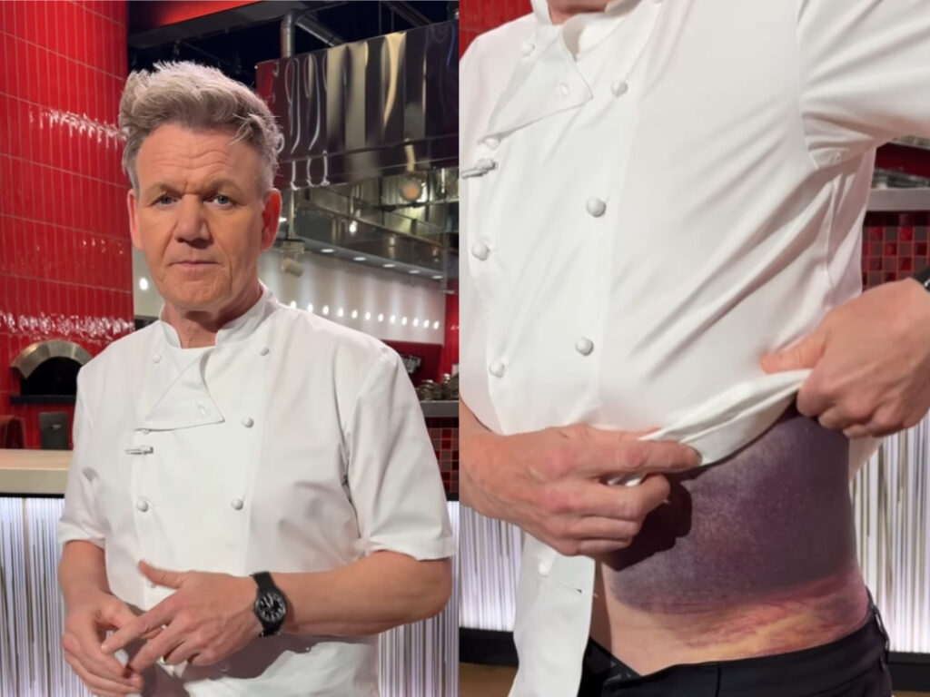 Gordon Ramsay mal vážnu nehodu. „Som rád, že som tu“