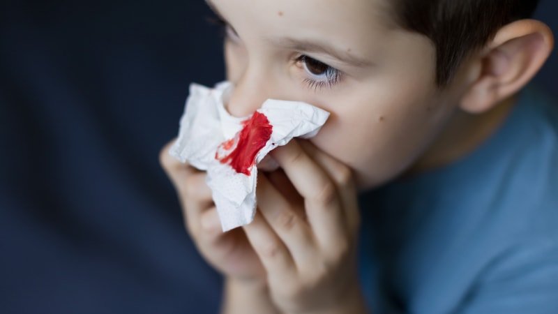 Krvácení z nosu: Neškodná záležitost, ale i příznak vážnějšího problému. Kdy zpozornět? Krvácení z nosu: Neškodná záležitost, ale i příznak vážnějšího problému. Kdy zpozornět?