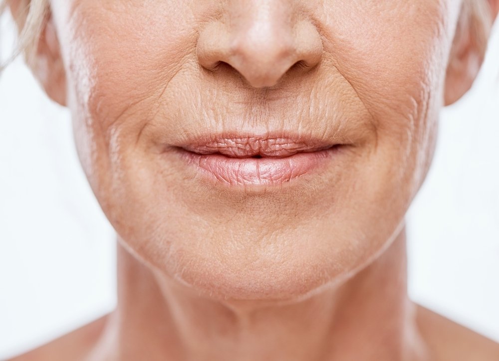 Ako odstrániť vrásky okolo úst? Zabudnite na botox. Pomôcť vám môže lacná maska z dvoch zložiek