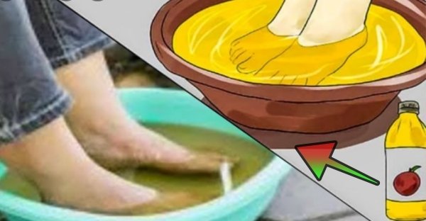 Toto všetko sa s Vaším telom začne diať, keď namočíte nohy do octu! Toto sú doslova zázračné tipy na jeho využitie! Skutočný pomocník do každej domácnosti! Toto všetko sa s Vaším telom začne diať, keď namočíte nohy do octu! Toto sú doslova zázračné tipy na jeho využitie! Skutočný pomocník do každej domácnosti!