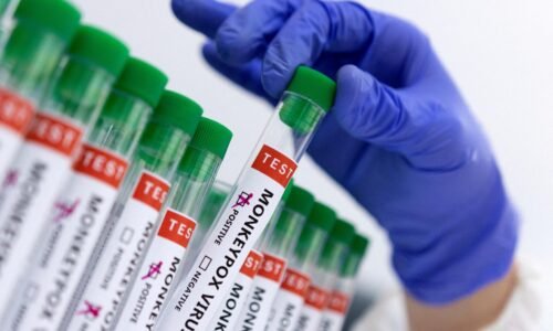 Kongo bude mať do niekoľkých dní vakcíny proti chorobe mpox, tvrdí šéf WHO