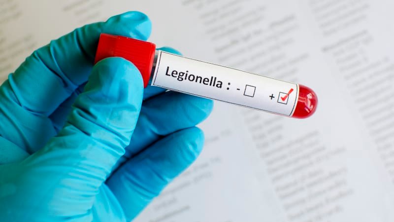 Itálii straší epidemie legionářské nemoci: Nikdo neví, kde se vzala. Šíří se už i Českem Itálii straší epidemie legionářské nemoci: Nikdo neví, kde se vzala. Šíří se už i Českem