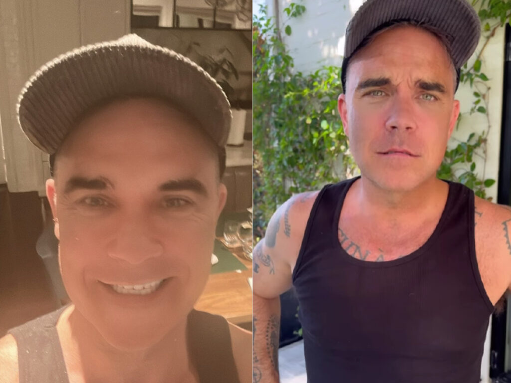 Robbie Williams obdivuje svoje nové zuby. Tie staré zničil na kokaíne a otváraním fliaš