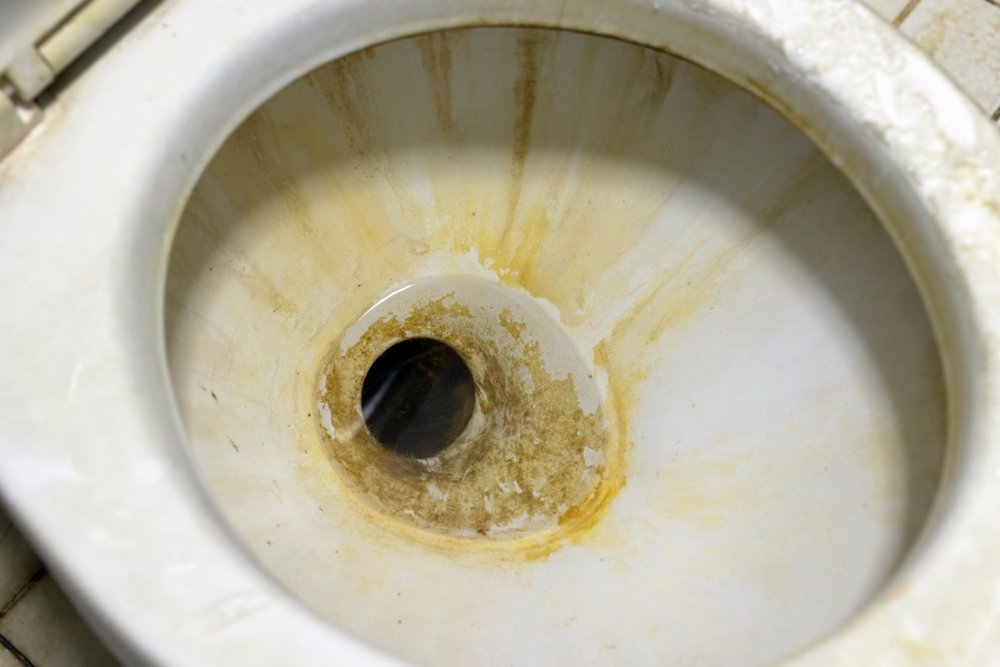 Vezmite lyžičku a nasypte ju do toalety. Bude sa lesknúť ako perla a zápach zmizne Vezmite lyžičku a nasypte ju do toalety. Bude sa lesknúť ako perla a zápach zmizne