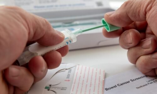Mirka s diagnózou rakoviny hrubého čreva: Život mi zachránila pozvánka na preventívnu prehliadku