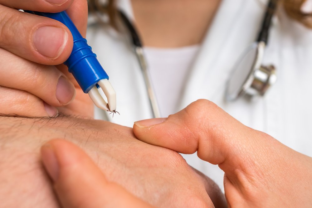 Lymská borelióza – príznaky, liečba a ako jej predísť Lymská borelióza – príznaky, liečba a ako jej predísť