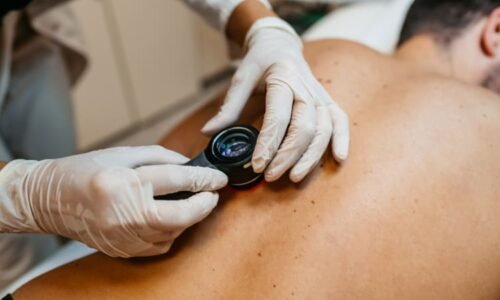 Zkontrolujte znaménka, nabádají po létě odborníci. Připomněli prevenci i na co si dát pozor