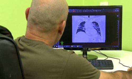 Česko trápí atypické zápaly plic. Často onemocní mladí, kteří nikdy nestonali, líčí lékařka