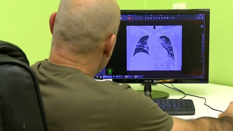 Česko trápí atypické zápaly plic. Často onemocní mladí, kteří nikdy nestonali, líčí lékařka Česko trápí atypické zápaly plic. Často onemocní mladí, kteří nikdy nestonali, líčí lékařka