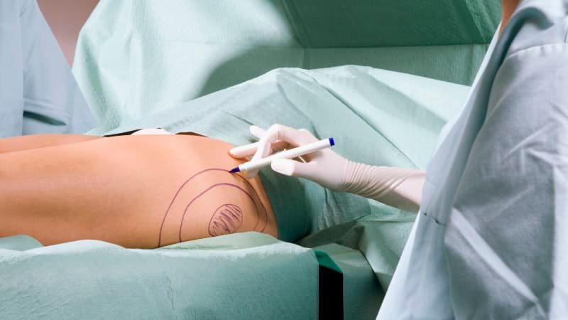 Plastická chirurgie nejsou jen nová prsa, léčí i duši. Experti z Česka na misích improvizují Plastická chirurgie nejsou jen nová prsa, léčí i duši. Experti z Česka na misích improvizují