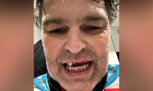 Jágr přišel při zápase o několik zubů. Zranění vtipně okomentoval, přidali se další sportovci