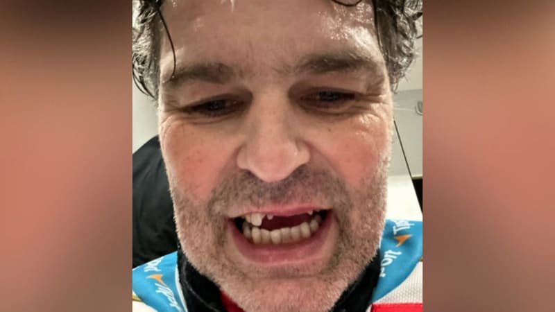 Jágr přišel při zápase o několik zubů. Zranění vtipně okomentoval, přidali se další sportovci Jágr přišel při zápase o několik zubů. Zranění vtipně okomentoval, přidali se další sportovci