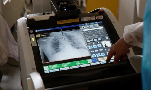 Znaky jedného druhu rakoviny je teraz možné zistiť pri výdychu