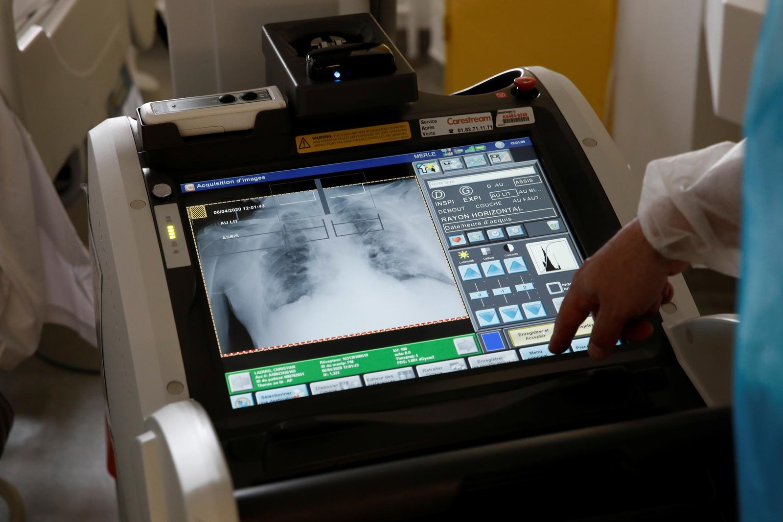 Znaky jedného druhu rakoviny je teraz možné zistiť pri výdychu Znaky jedného druhu rakoviny je teraz možné zistiť pri výdychu