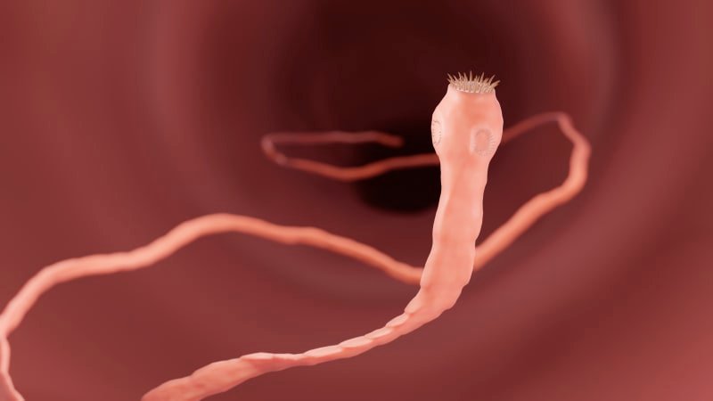 Šílený snímek, zděsil se lékař. Američan si zlomil nohu, rentgen ukázal tělo plné tasemnic