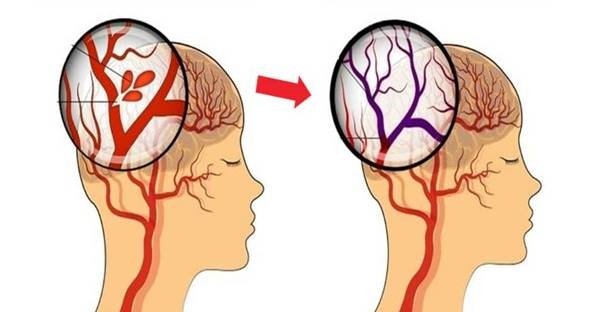 Prečítať si to Vám zaberie iba jedinú minútu, ale dokáže to zachrániť život: Vždy ide o sekundy! Prečítať si to Vám zaberie iba jedinú minútu, ale dokáže to zachrániť život: Vždy ide o sekundy!