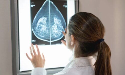 Odkaz Aničky Slováčkové žije dál: Lékaři hlásí více prohlídek, prevence může zachránit život