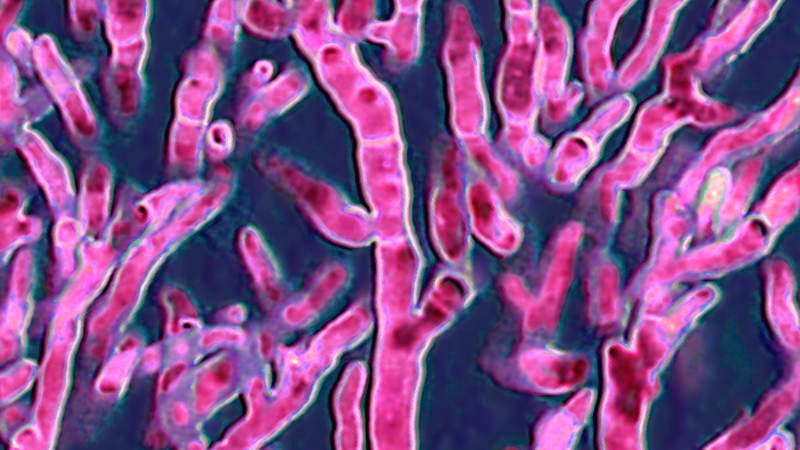 Hrozí šíření houby, která člověka „sežere zevnitř“, tvrdí experti. Registrují znepokojivý trend