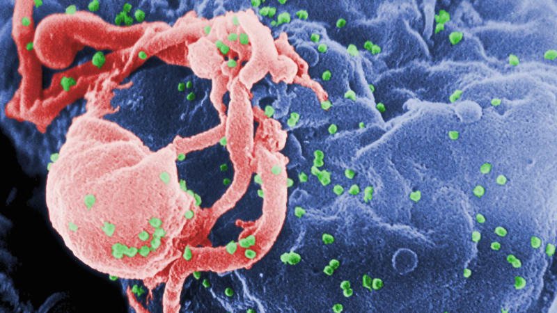 Zatočí revoluční injekce s AIDS? Úřad schválil preventivní léčbu, tým vědců vede český lékař