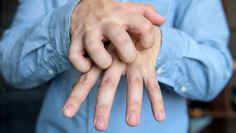 Odborníci varují před svrabem. Oblíbená destinace Čechů hlásí nárůst o 750 procent Odborníci varují před svrabem. Oblíbená destinace Čechů hlásí nárůst o 750 procent