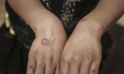 V Česku se objevila nebezpečná nemoc. Z koní je přenosná na lidi, může skončit i smrtí