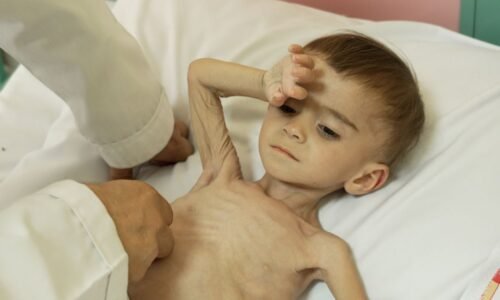 Afganistan: Plačúce deti oslabené hladom zapĺňajú afganskú nemocnicu – rodičia sa obávajú, že každý deň môže byť ich posledný