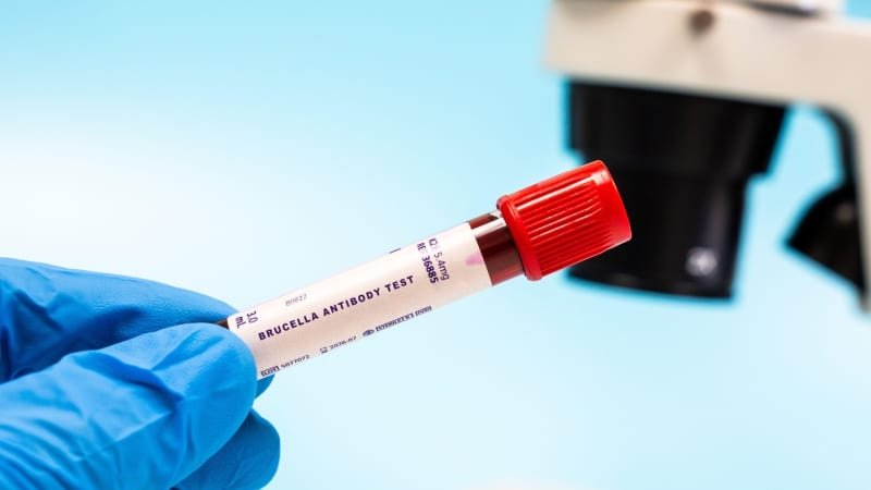 Nebezpečná brucelóza PŘEHLEDNĚ: Není to jen nemoc zvířat, může končit smrtí. Jaké jsou příznaky? Nebezpečná brucelóza PŘEHLEDNĚ: Není to jen nemoc zvířat, může končit smrtí. Jaké jsou příznaky?