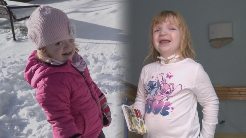 Šťastný konec malé Lilinky. Po sérii operací se změnila k nepoznání, maminka děkuje za podporu Šťastný konec malé Lilinky. Po sérii operací se změnila k nepoznání, maminka děkuje za podporu