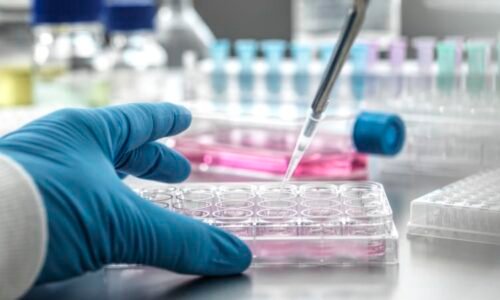 Virus ptačí chřipky H5N5 se poprvé přenesl na člověka. Usmrtil chovatele drůbeže v USA