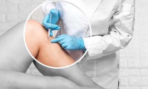 Zarastený necht, hrčka pod kožou či žily ako mapa? Kedy je čas na chirurgickú intervenciu