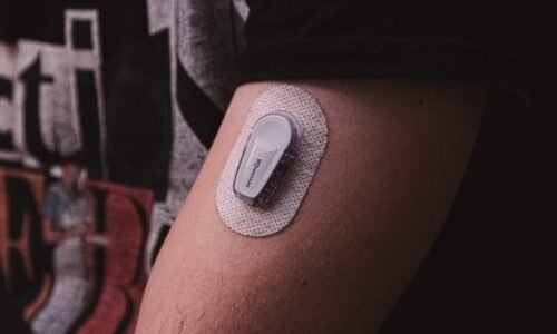 Senzory změnily léčbu cukrovky. Na revoluční technologii dosáhne část diabetiků 2. typu