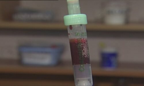 Zloděj v Praze bodl člena ochranky injekční stříkačkou. Je nakažená žloutenkou, varoval Zloděj v Praze bodl člena ochranky injekční stříkačkou. Je nakažená žloutenkou, varoval