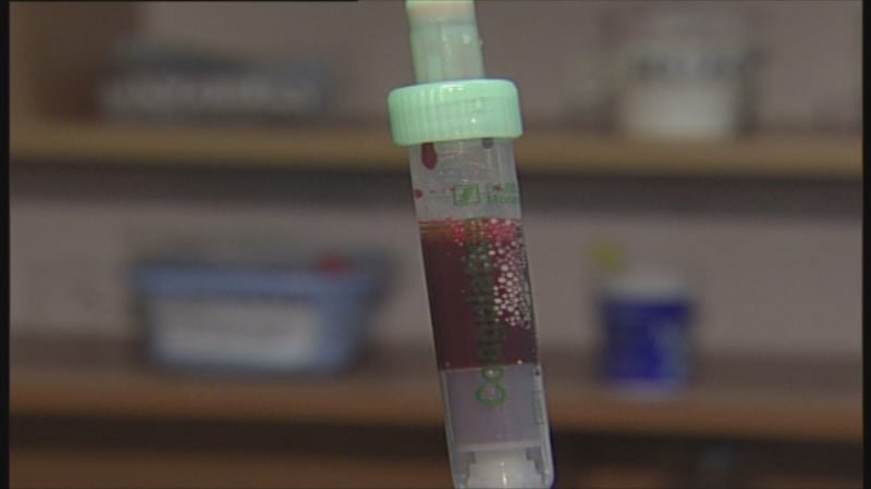 Zloděj v Praze bodl člena ochranky injekční stříkačkou. Je nakažená žloutenkou, varoval