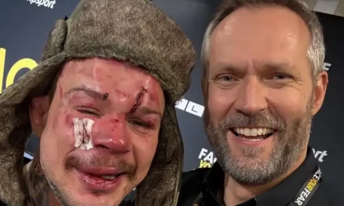 Takmer sa po zápase nespoznal. robo pukač vysvetlil, prečo aj napriek prehre je na seba hrdý. si zo zápasu zobral