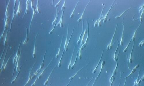 Skandál s darovaným spermatem otřásá Evropou: Zemřelo několik dětí, rodiny se bojí rakoviny