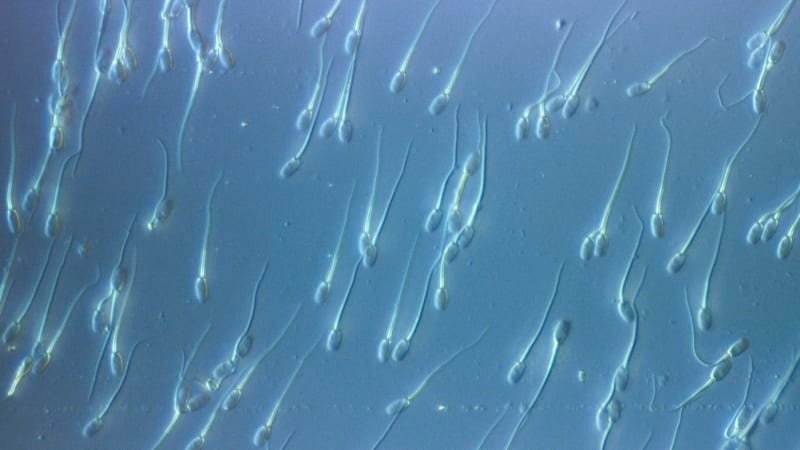 Skandál s darovaným spermatem otřásá Evropou: Zemřelo několik dětí, rodiny se bojí rakoviny