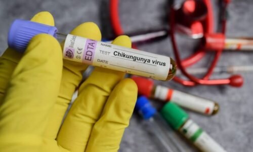 Do Evropy se dostal virus chikungunya. Jaké jsou příznaky a jak předejít nákaze? Do Evropy se dostal virus chikungunya. Jaké jsou příznaky a jak předejít nákaze?