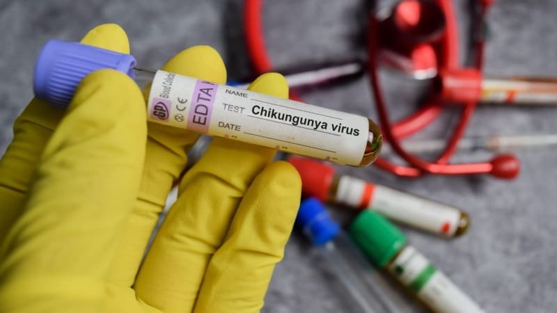 Do Evropy se dostal virus chikungunya. Jaké jsou příznaky a jak předejít nákaze? Do Evropy se dostal virus chikungunya. Jaké jsou příznaky a jak předejít nákaze?